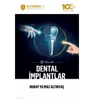 50 Soruda Dental İmplantlar